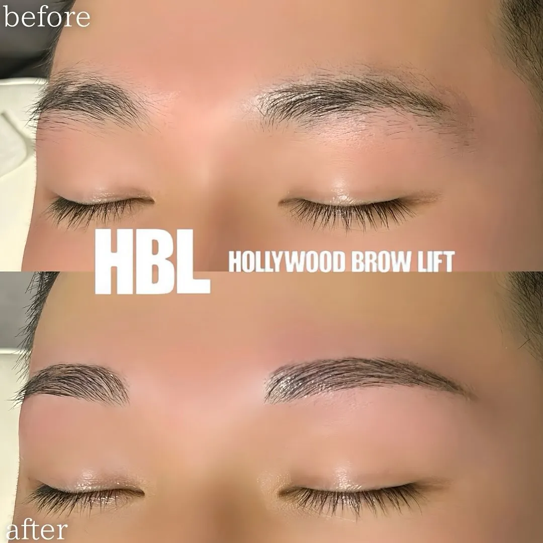 【近江八幡 メンズハリウッドブロウリフト 安い】